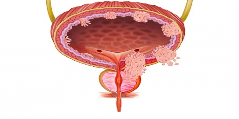 surgical-oncologist-in-lucknow